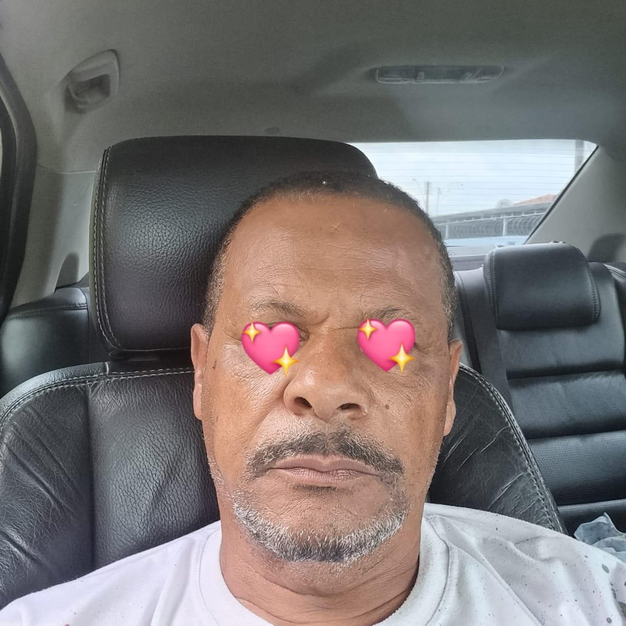 Foto de acompanhamento após procedimento facial