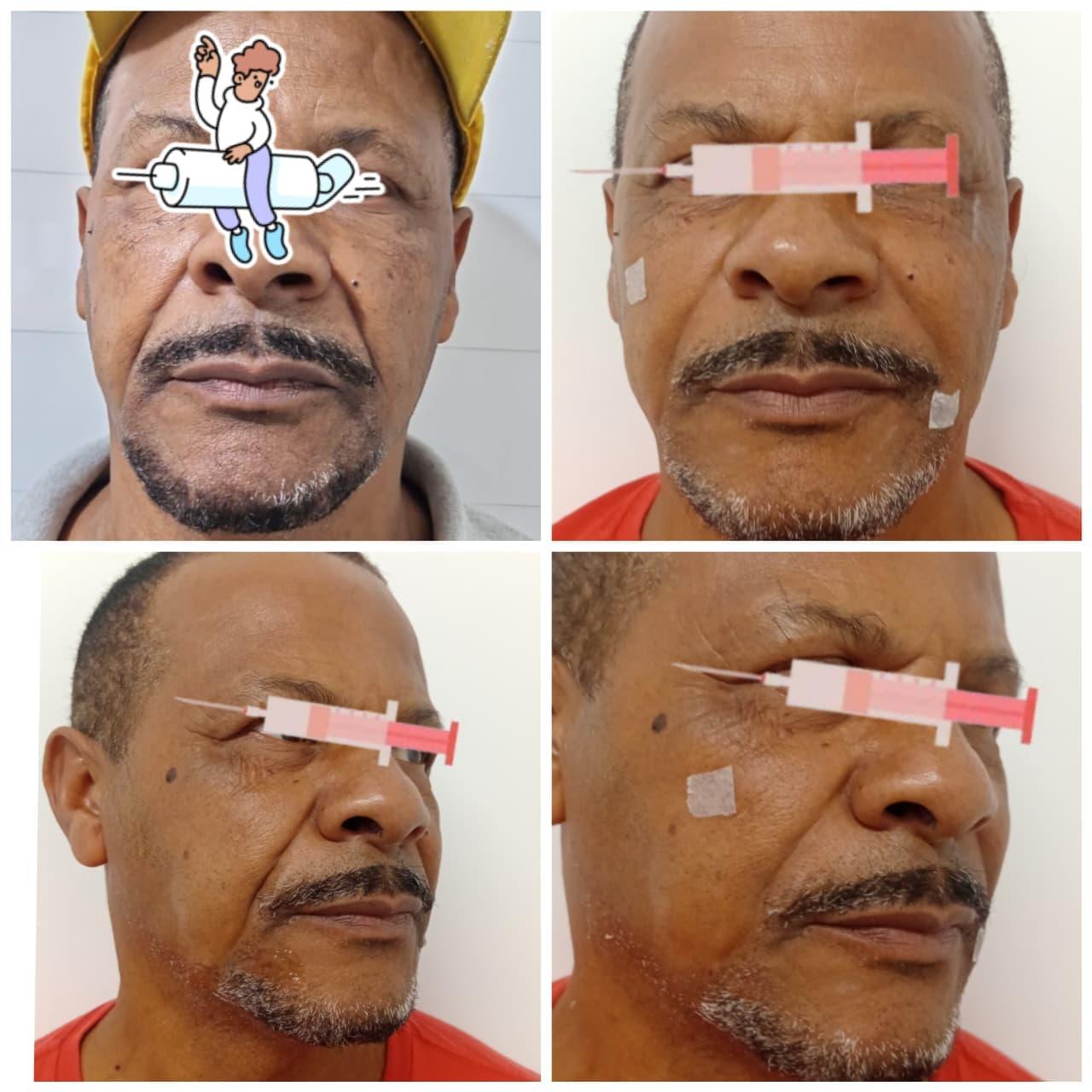 Registro de acompanhamento de tratamento facial masculino