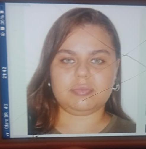Registro anterior ao tratamento de papada com enzima