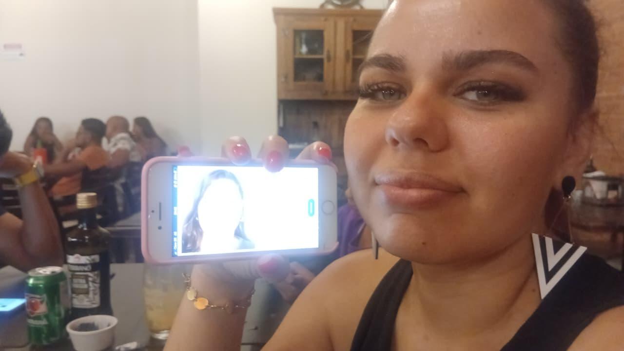 Registro posterior ao tratamento de papada com enzima